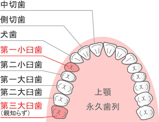 一般矯正で抜歯対象になりやすい歯