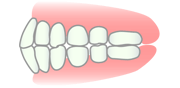上下顎前突