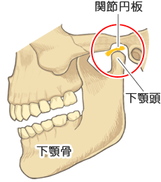 開口障害 - 痛くて口を開くことができない