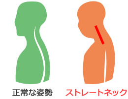 “顎関節症が原因の“のど”の異物感