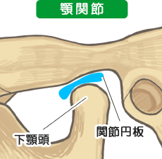 顎関節症の構造