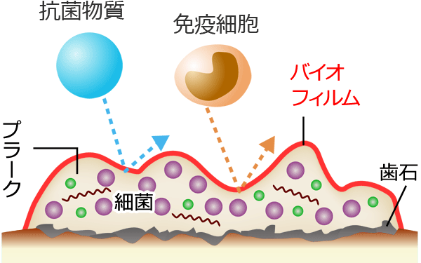 歯に付着したバイオフィルム