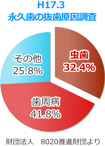 平成１７年 ８０２０推進財団「永久歯の抜歯原因調査」より