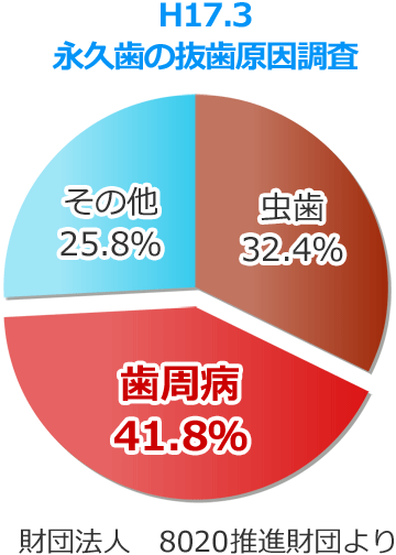 平成１７年 ８０２０推進財団「永久歯の抜歯原因調査」より