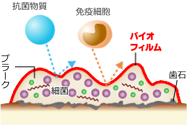 歯周病菌とバイオフィルム