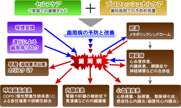 歯周病が悪影響を及ぼす全身疾患