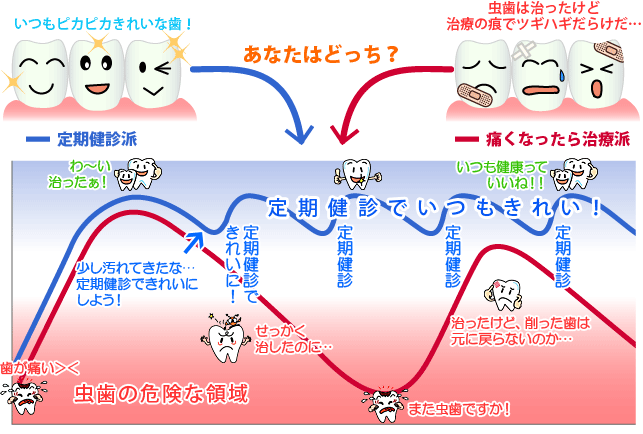 あなたはどっち？ 歯科定期健診の意義