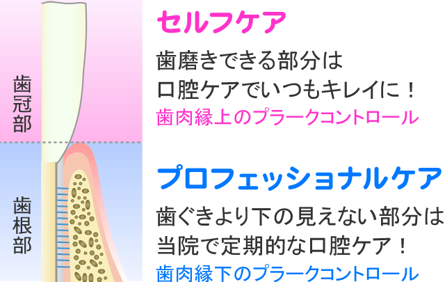 予防歯科 | 前橋市の歯医者さん「青柳歯科クリニック」