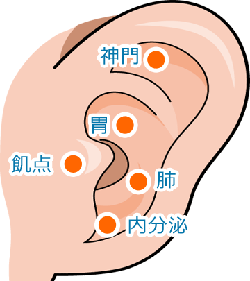 耳つぼダイエット 前橋市の歯医者さん 青柳歯科クリニック